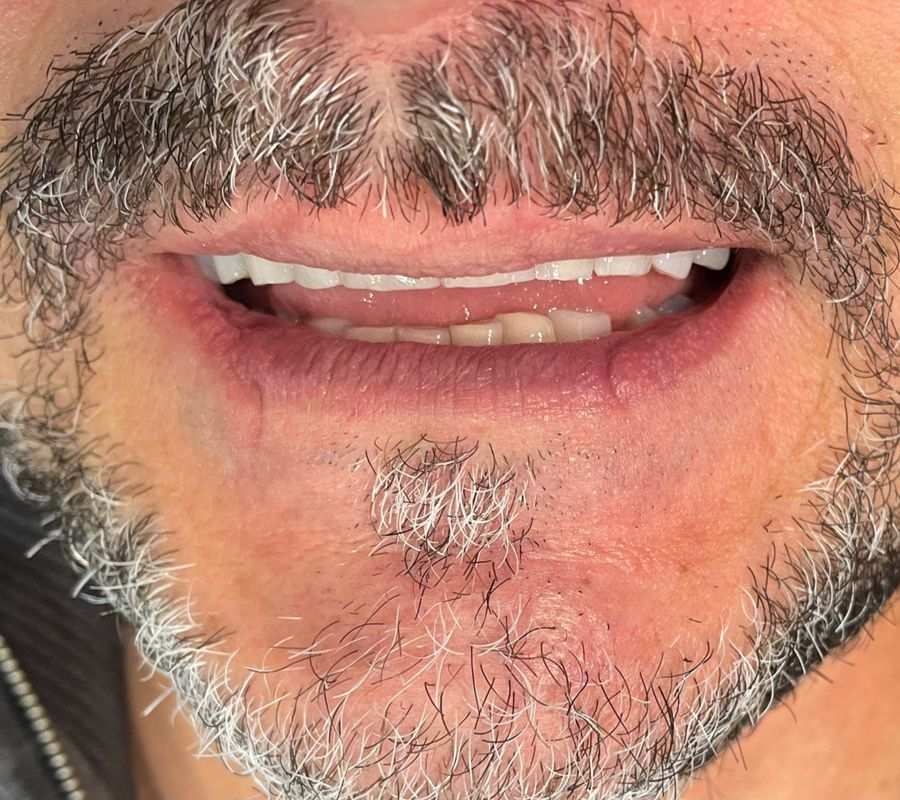 after treatment image