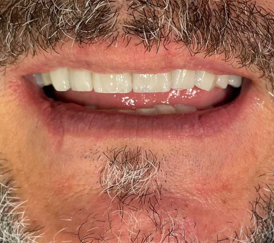 before treatment image